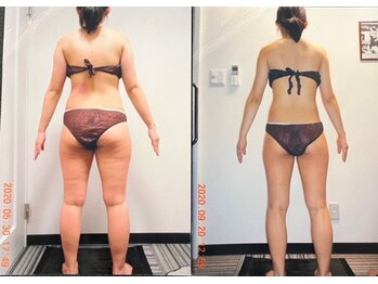 パーフェクトボディプレミアム 大阪梅田店(PERFECT BODY PREMIUM)/お客様　ビフォーアフター（27）