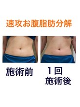 鍼灸サロンオランジュ 高槻富田院/