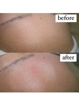 テンパ ビューティー(+10%beauty)/一撃タマゴ肌ワックス