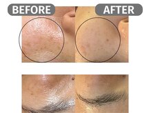 インフィニート 上野毛(infinito)/★BEFORE/AFTER★