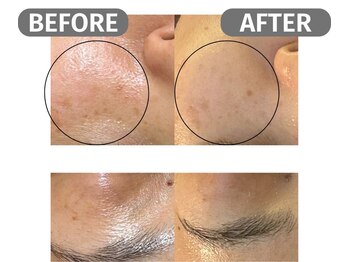 インフィニート 上野毛(infinito)/★BEFORE/AFTER★