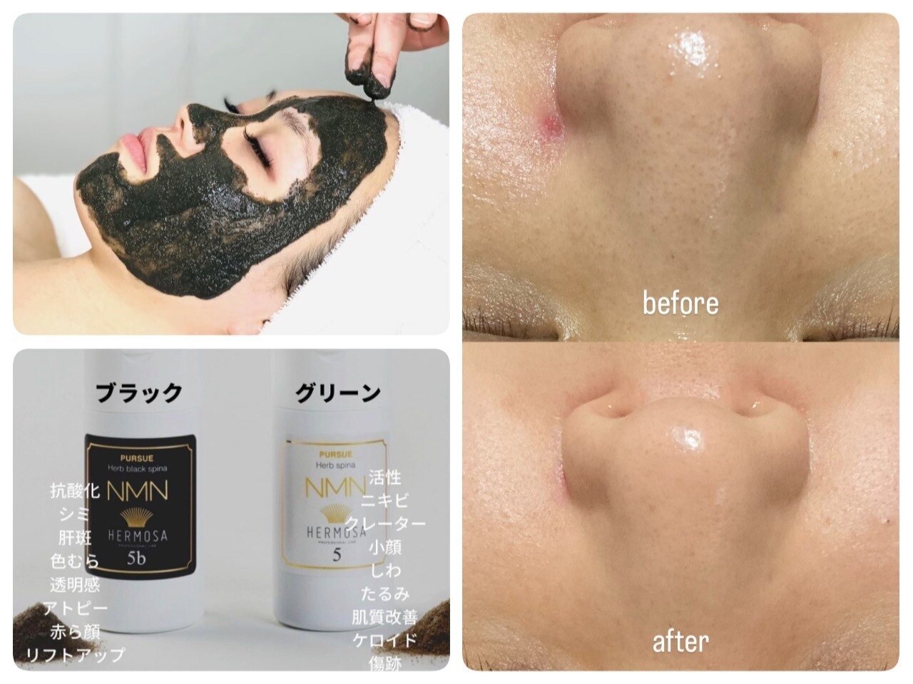 YA-MAN(ヤーマン) レイボーテR フラッシュハイパー for Salon