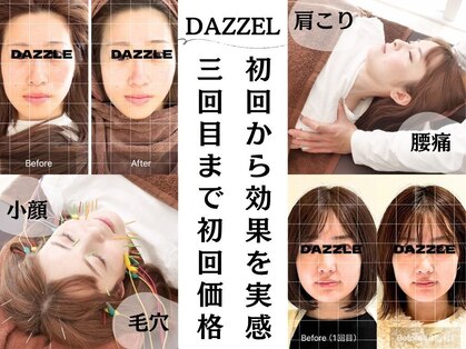 ダズル(DAZZLE)の写真