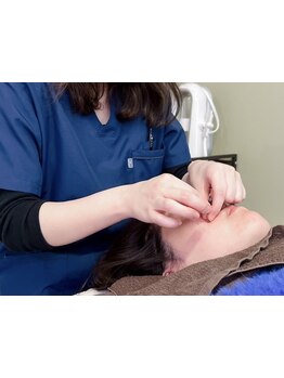 鍼灸施術を受けたい