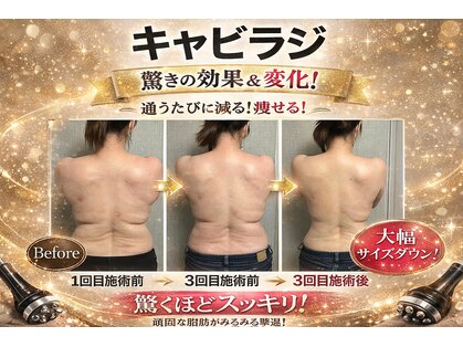 アンベリール(embellir)の写真