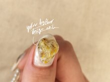 アンテテネイル(ANTETENAIL)/