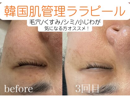 グレイティア(gratia)の写真