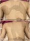 グレイスボディ BiViつくば店(Grace Body)の写真/背中・うなじ脱毛で後ろ姿美人！脱毛機ランキング3部門1位の感動をあなたに♪