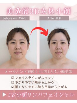 ユニクリア 佐賀(Uniclear)の写真/【J式小顔リンパフェイシャル】1回の施術で圧倒的小顔へ。美容家サロンで叶える小顔&美肌。レモンボトル◎
