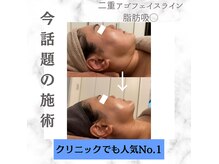 ビューティーツリー(Beauty Tree)の雰囲気(ララピールで毛穴さよなら!)