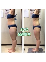 美ボディラボ(美Body Labo)/20代全身痩せ
