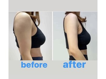 サロン ド プリヴェ(Salon de PRIVE)/華奢な肩周り&二の腕を目指す