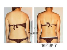 アルファイン 諏訪店/2ヶ月の変化！！