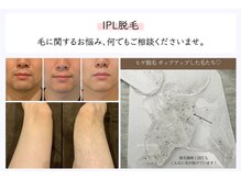 男性の肌トラブルを徹底改善！肌質に合わせた施術でお悩み解決★