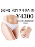 女性ワキ&VIO脱毛☆7,700円→4,300円