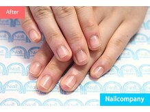 ネイルカンパニー/爪噛みをやめて手を堂々と出す