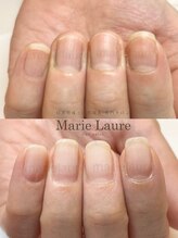 マリーロール 淀屋橋本店(Marie Laure)/自爪育成/深爪矯正/ネイルケア