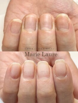 マリーロール 淀屋橋本店(Marie Laure)/自爪育成/深爪矯正/ネイルケア