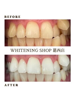 ホワイトニングショップ 葛西店/歯科提携 ホワイトニング専門店