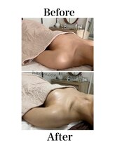 ハリムーン 仙台(harimoon)/ブライダル