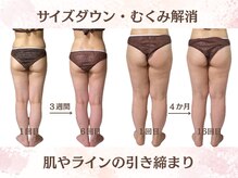 ラニカイ 八代店(Lanikai)