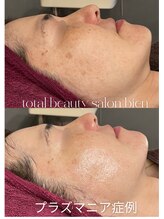 ビエン(bien)/何歳からでも綺麗になれる！