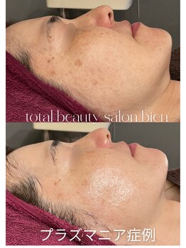 ビエン(bien)/何歳からでも綺麗になれる！