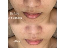 レイニゲン(H/Reinigen)の雰囲気（お客様1人1人に合わせた改善最短ルートをご案内致します♪）