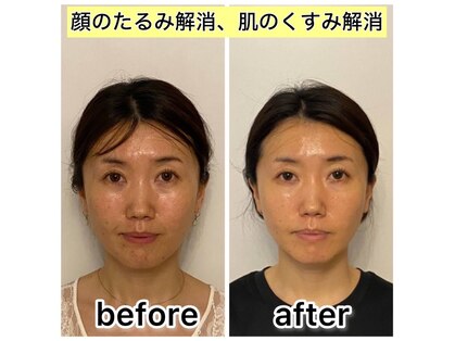 ドクターコガオ 福山店(Dr.小顔)の写真