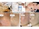 ビオラ(美ola)の写真/【春のゆらぎ肌/花粉対策】韓国肌管理ダクトピールで水光ツヤ肌へ♪