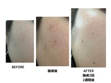 アトリエ ドゥ アエル(atelier du AELLE)の雰囲気(脱毛からのたるみ改善へ)