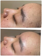 エースマイルイズ(A smile is..)/FACE WAXで美肌改善