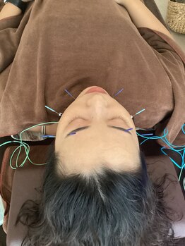 ハリファ鍼灸院 横浜関内院(HariFa鍼灸院)/美容施術