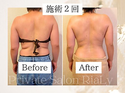 リアリー(RiaLy)の写真