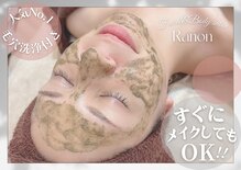ラノン(Ranon)