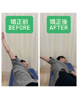 志村三丁目駅前鍼灸院 接骨院/矯正施術の前と後