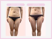 スリムライン 山形店(The Slim Line)/before→after