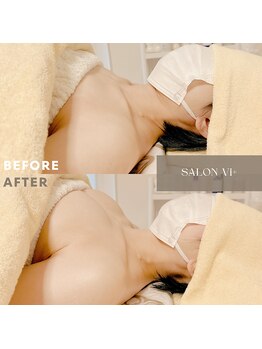 サロン ヴィプラス(SALON Vi+)/初回バストケアのBeforeAfter