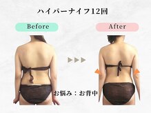 美容整体ウェリナ あま甚目寺院/小顔矯正/骨盤矯正/美脚サロン