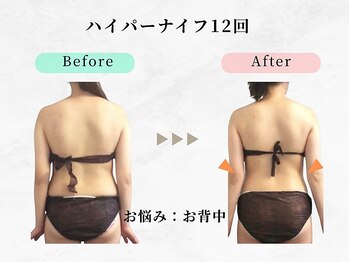 美容整体ウェリナ あま甚目寺院/小顔矯正/骨盤矯正/美脚サロン