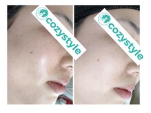 コージースタイル(cozy style)の雰囲気(ラミネーションピール+レモンボトル)