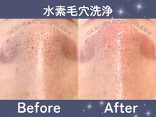パッパ(PAPPA)の雰囲気(脱毛×毛穴洗浄で黒ずみ撃退/水素水でお肌のサビを還元◎)