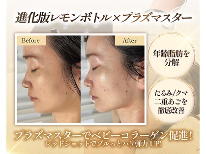シュシュ(Chouchou)の写真