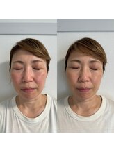 こうぞう整体院/美容鍼×筋膜リリース