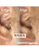 リゼクシー INTERNATIONAL麻布十番 六本木(RESEXXY)/