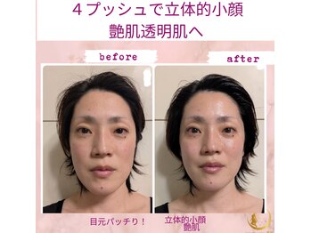 プライベートサロン 美月/タルミ毛穴ケア！