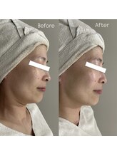 ウィール 栄 矢場町店(WE:LL)/小顔美肌フェイシャル