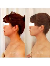 ミールーム(mi room)/小顔エステ