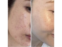 キュアリード(Cure_Lead)/最速・最短で変わる！