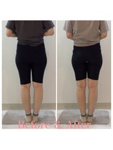 スタイルラボ高松/産後骨盤矯正の効果♪